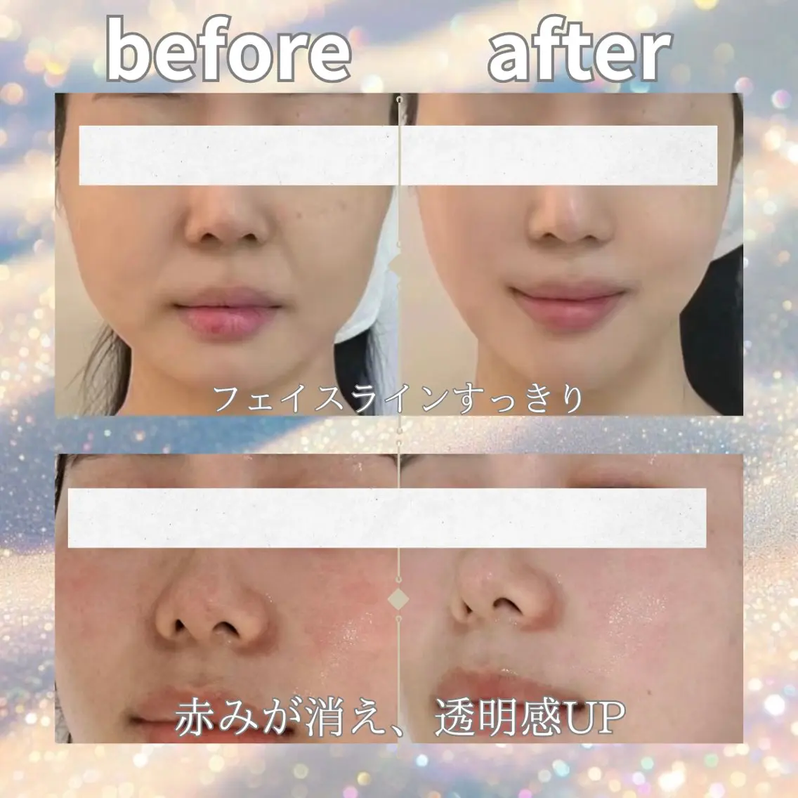 マツエク・マツパ エステ リラク 愛維美水光美肌専門店 メンズレディースokのエステ・リラクイメージ