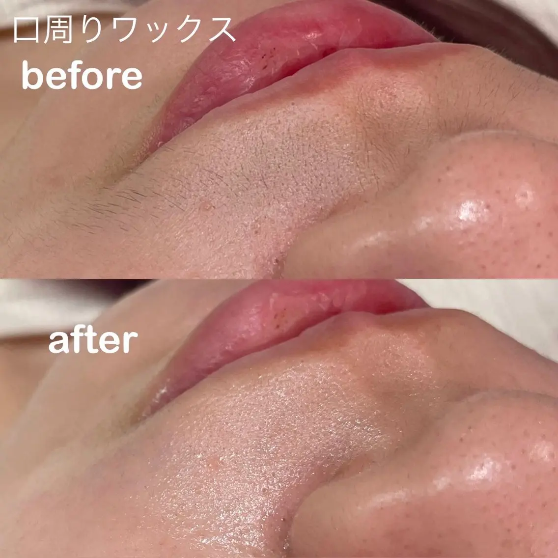 【🌟 フェイスワックスモデルさん募集 🌟】産毛・角質オフでつるん肌🫧の写真