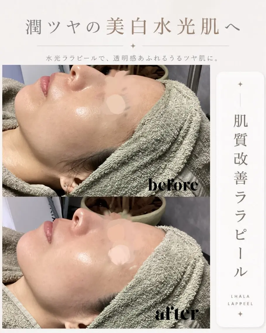 メンズ エステ 【BUB立川】 ゆかのエステ・リラクイメージ