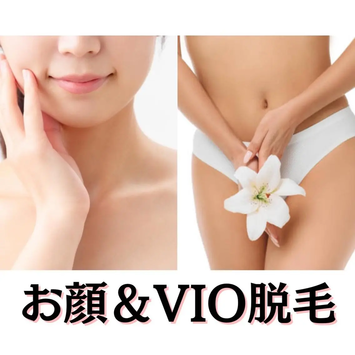 お手入れはもはやマナー❣️【お顔+VIO脱毛】デザイン可、保湿付き✨の写真