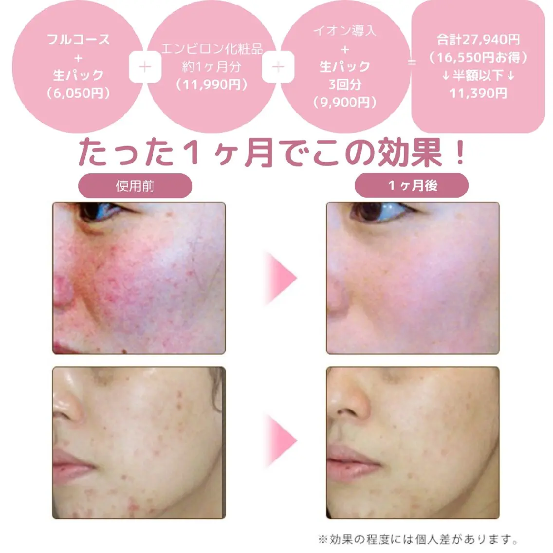 1ヶ月で肌質改善!エステモニター募集の写真