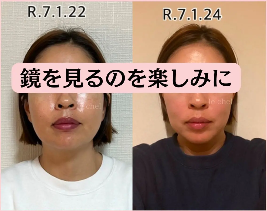 大人気❣️整形級『小顔矯正』エラを入れる・目を大きくするの得意です💪 首・肩・デコルテ/ホット・ストーン付きの写真