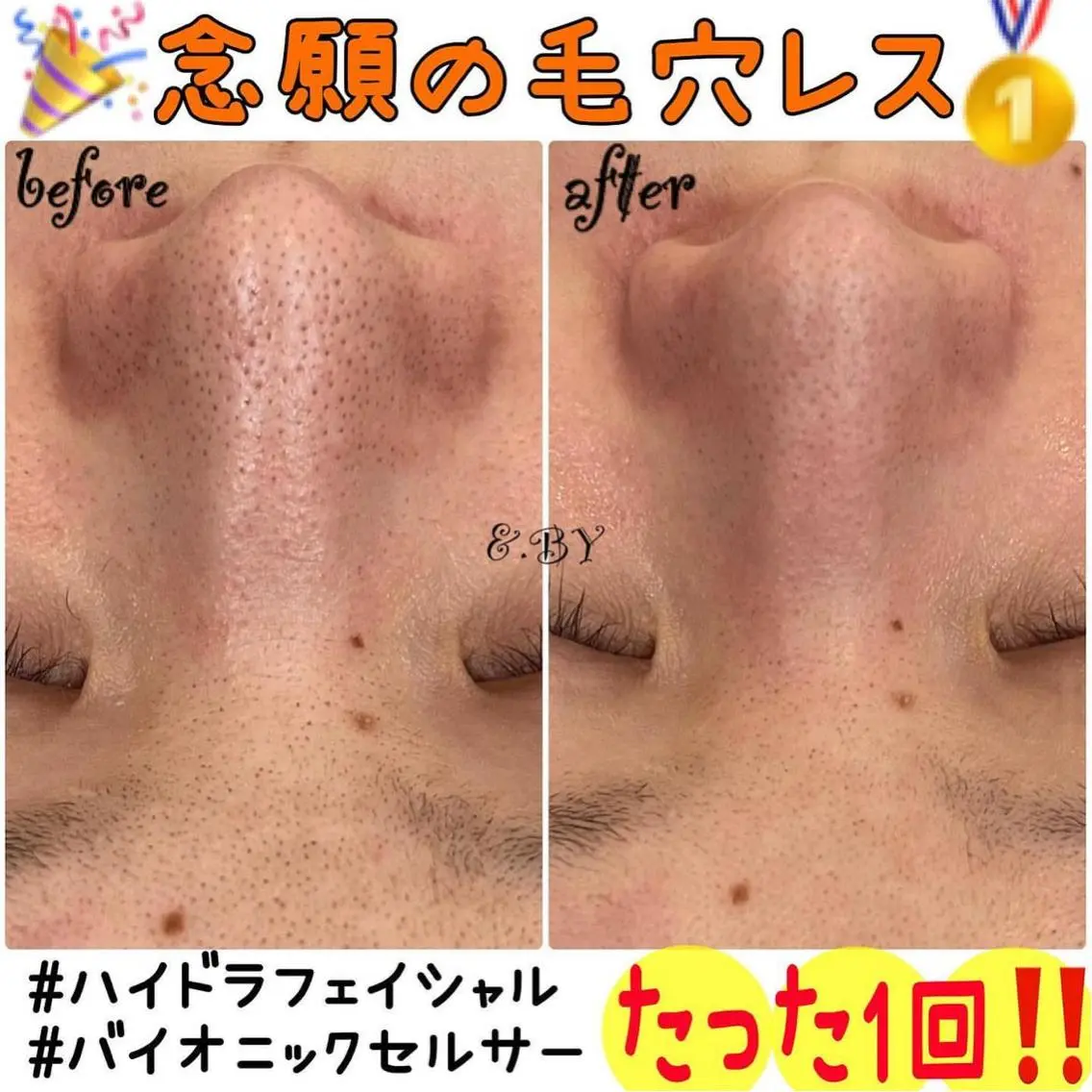 エステ &. BYのエステ・リラクイメージ