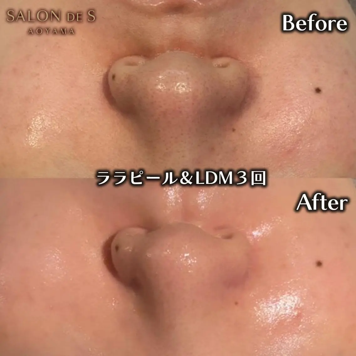 エステ SALON DE S 外苑前♡さやかのエステ・リラクイメージ