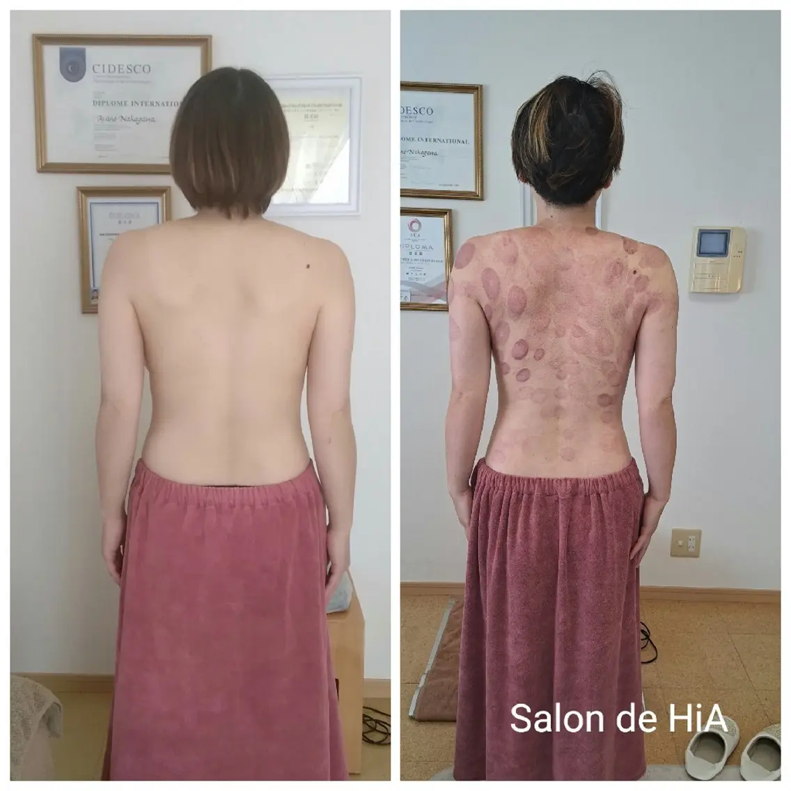 エステ リラク Salon de  HiAのエステ・リラクイメージ