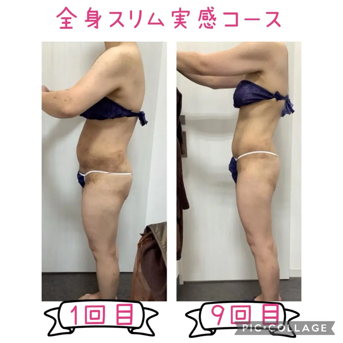 エステ REONZ 取手店のエステ・リラクイメージ