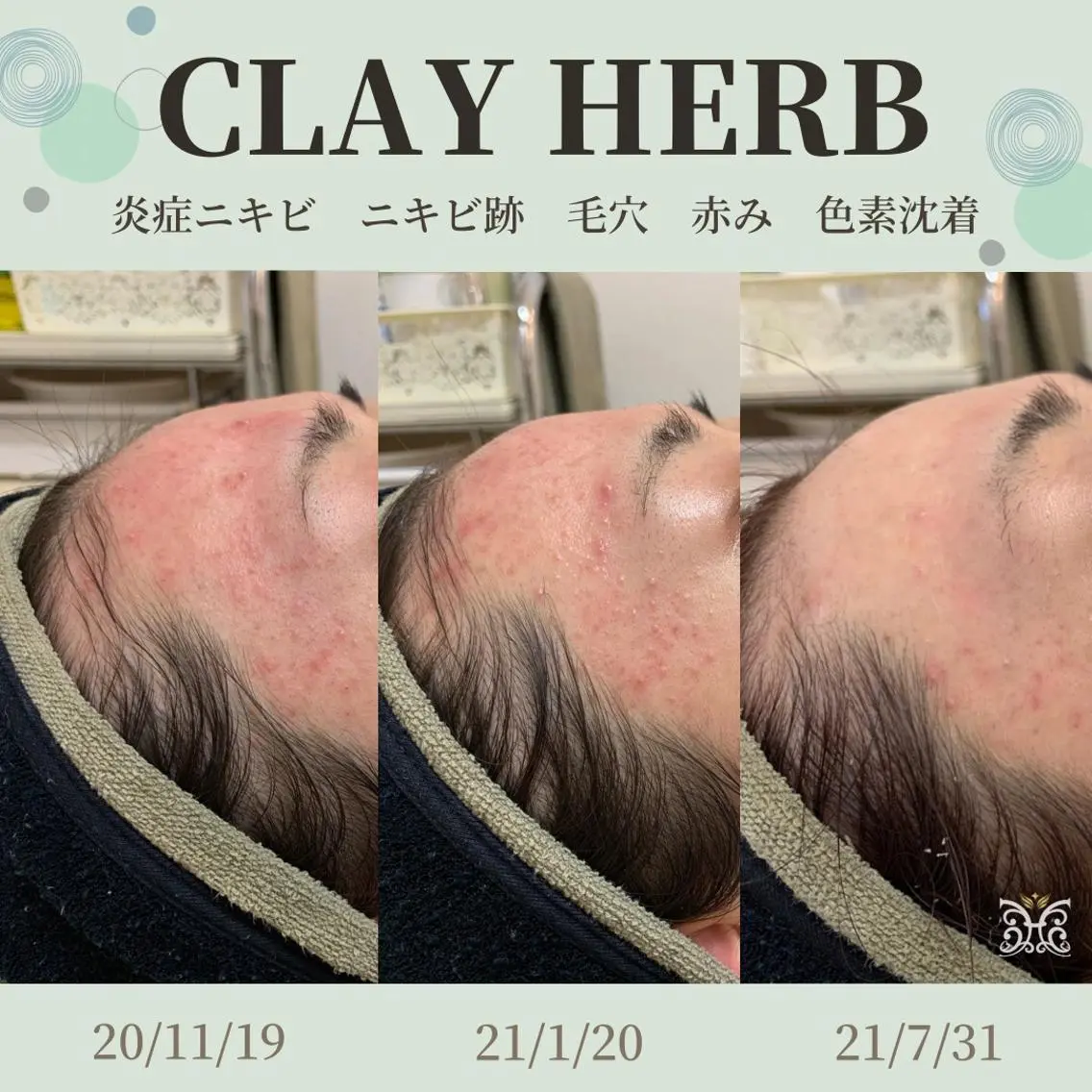 エステ リラク cerisier BEAUTÉのエステ・リラクイメージ