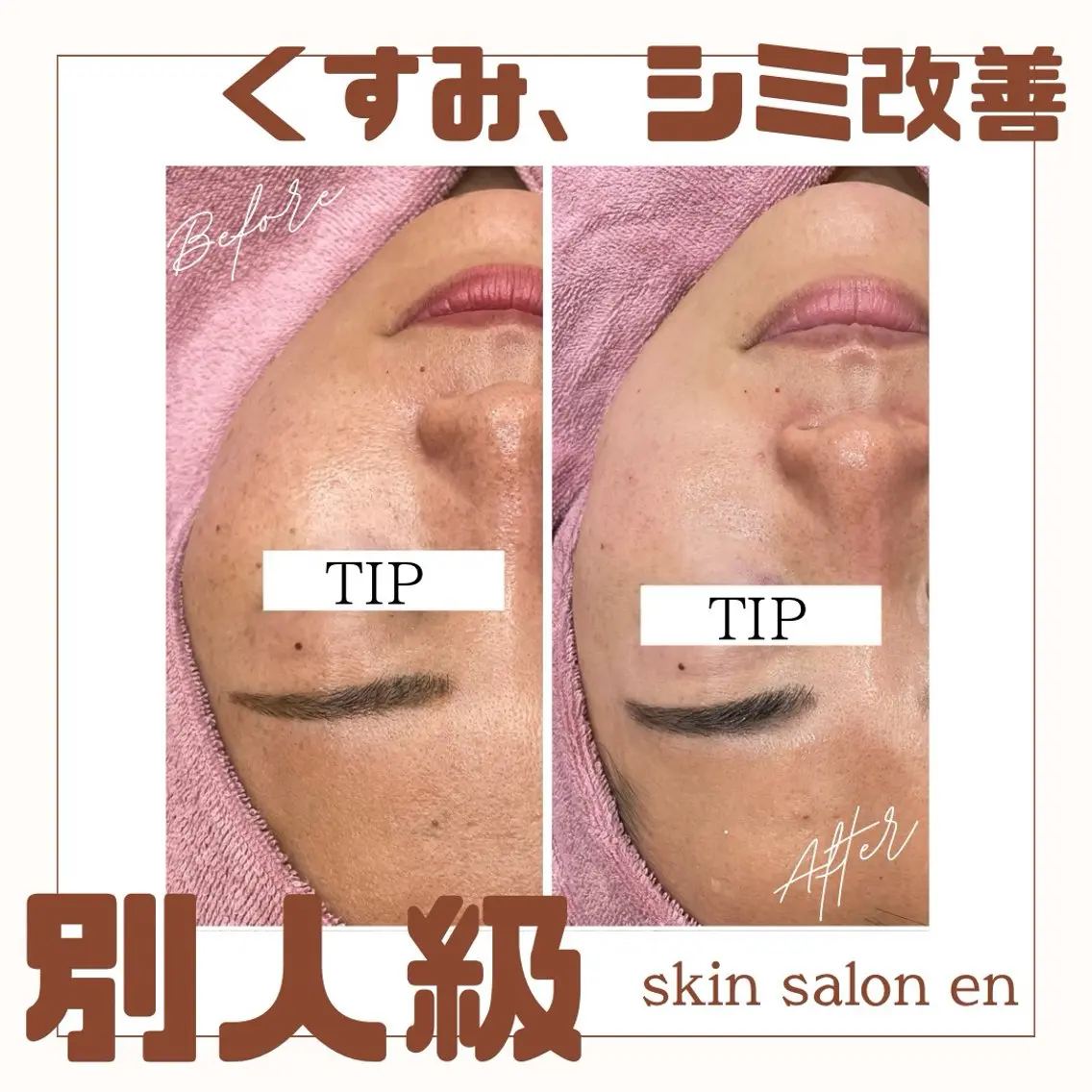 エステ skin salon enのエステ・リラクイメージ