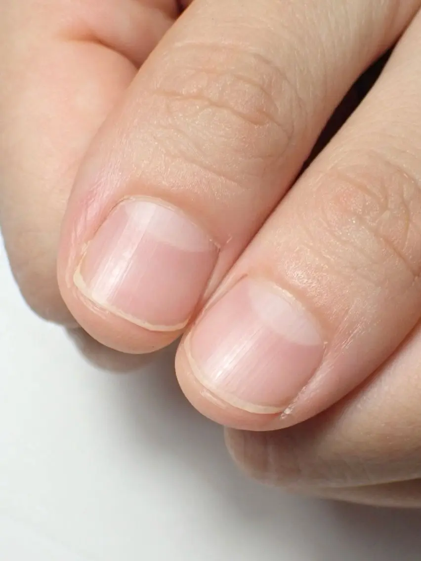 ネイルオフ💅の写真