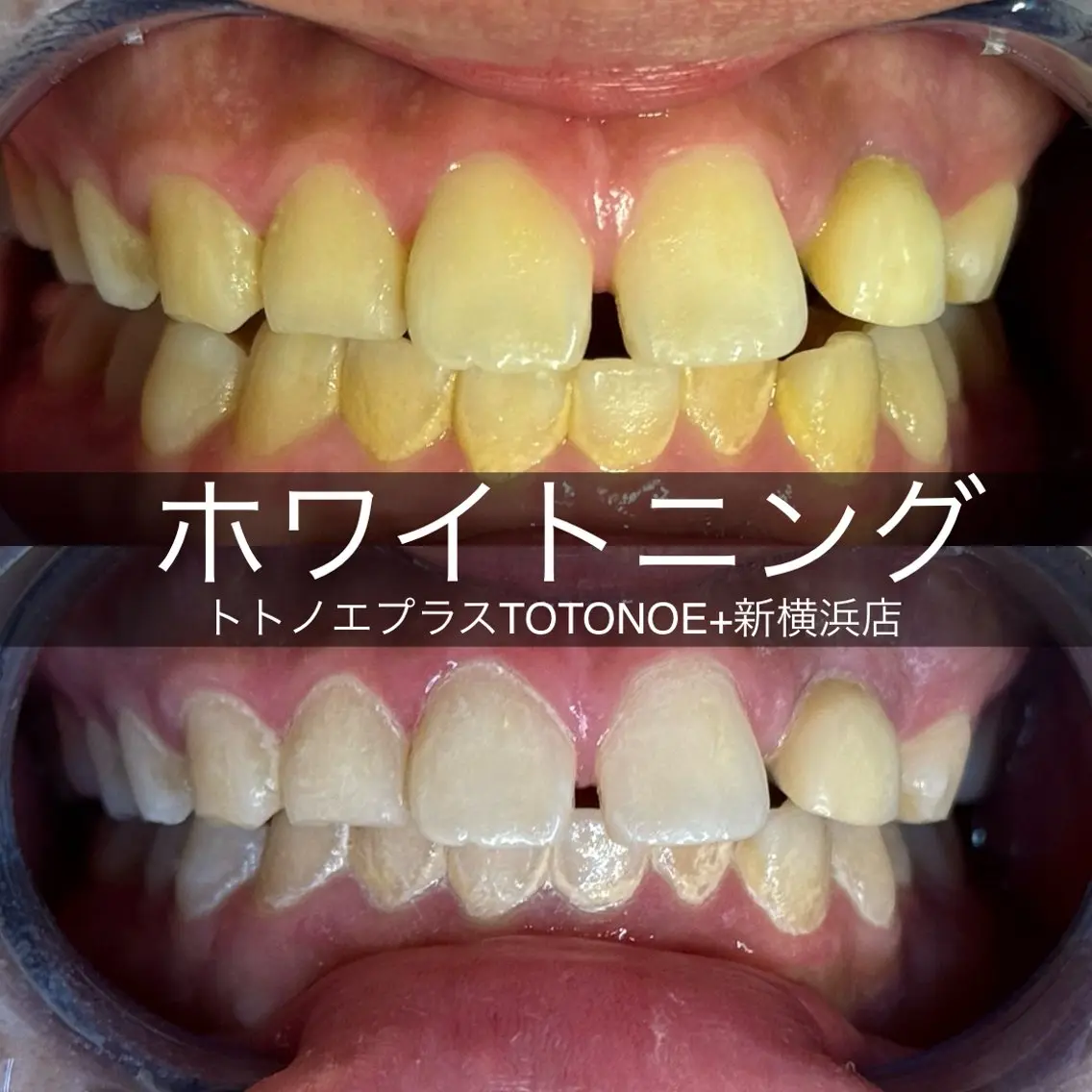 トトノエプラス 新横浜店の眉毛・アイブロウイメージ