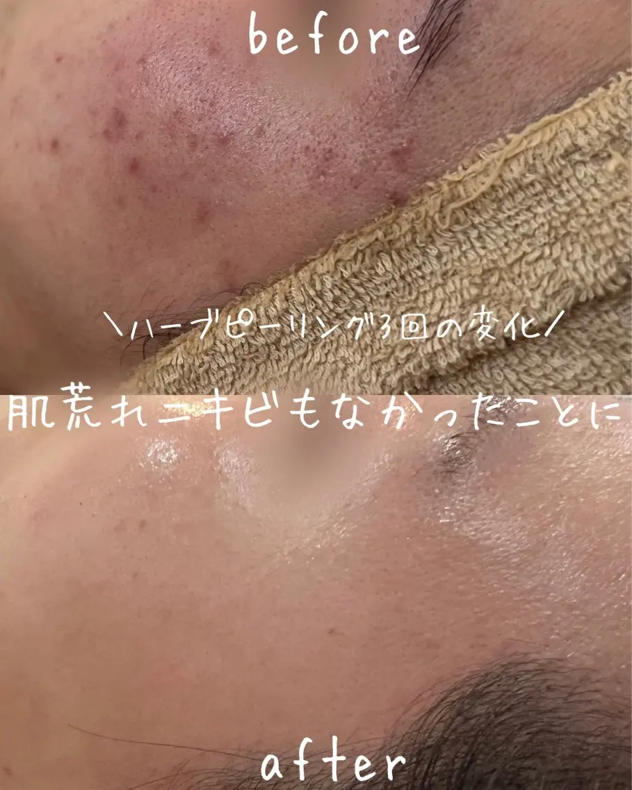 エステ miki 東根の肌質改善サロンのエステ・リラクイメージ