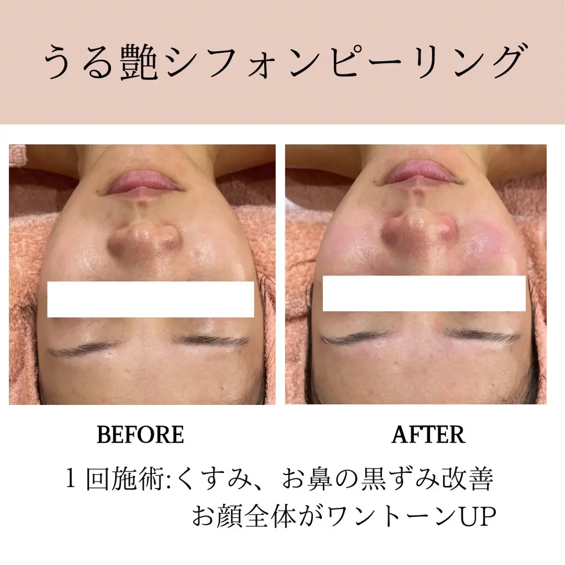 エステ 肌質改善専門サロン Bellmi/心斎橋のエステ・リラクイメージ