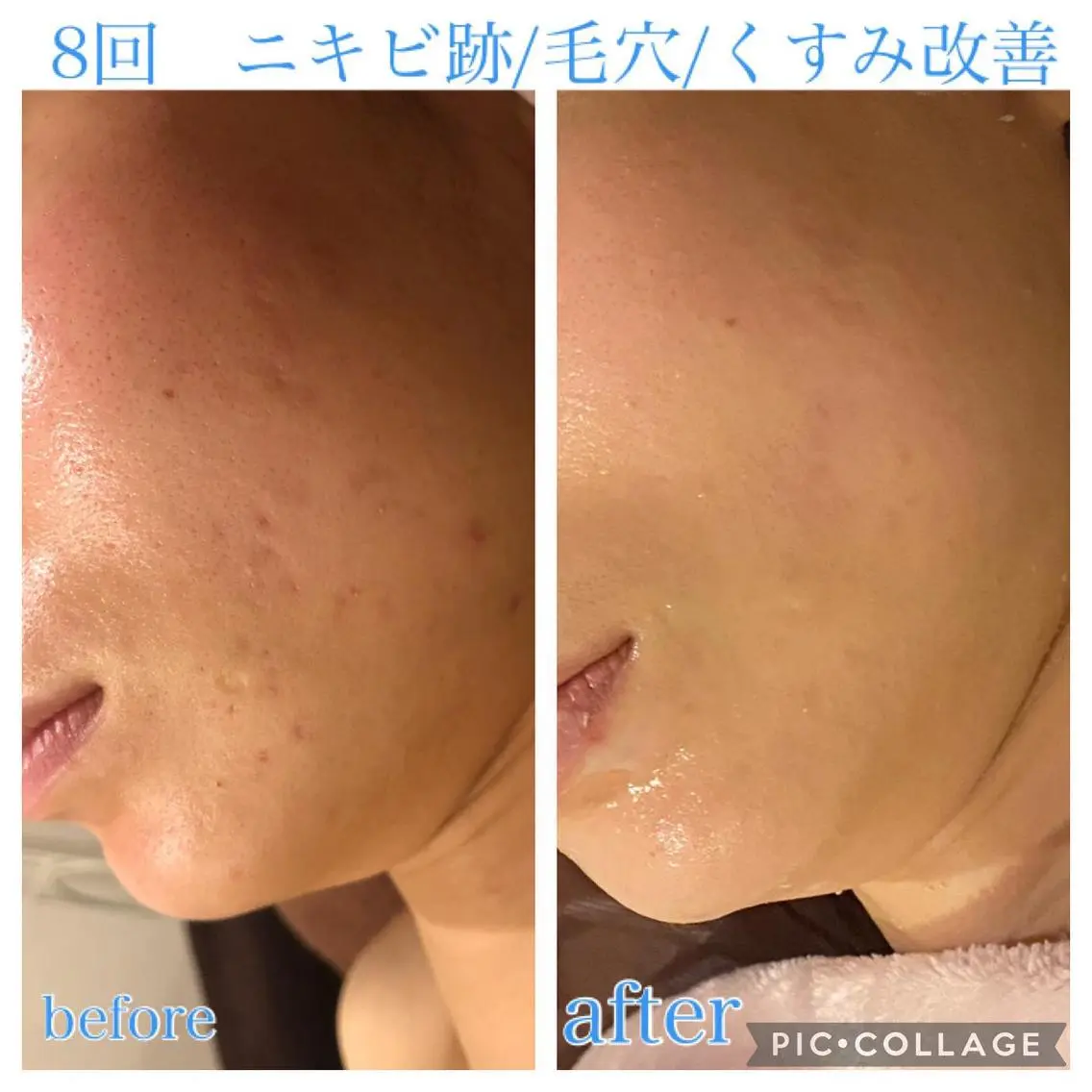 ミディアム カラー パーマ ヘアアレンジ メンズ ネイル マツエク・マツパ エステ リラク EnsorClair 代表 野口真央のエステ・リラクイメージ