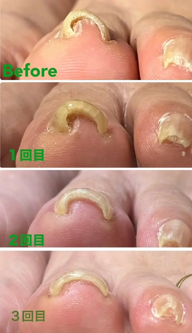 その他 B-BAUM  nailsalon のその他イメージ