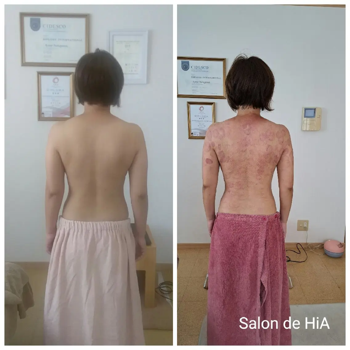 エステ リラク Salon de  HiAのエステ・リラクイメージ