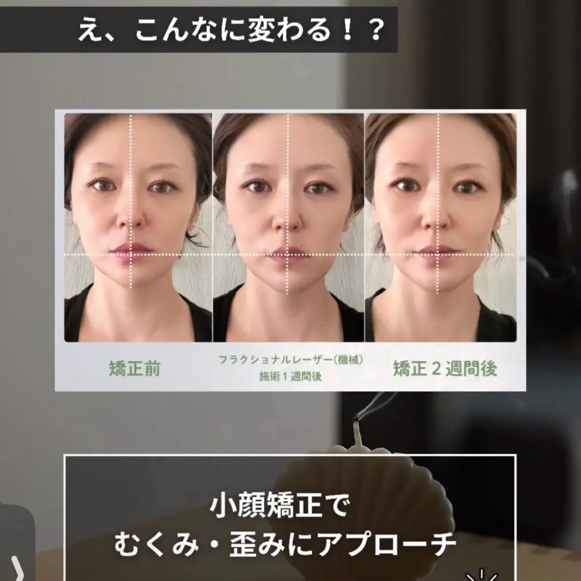 凄腕整体師直伝【小顔矯正】💆🏻‍♀️💆🏻フェイスラインをキュッと！たるみや歪みには骨格や筋肉へのアプローチを👐の写真