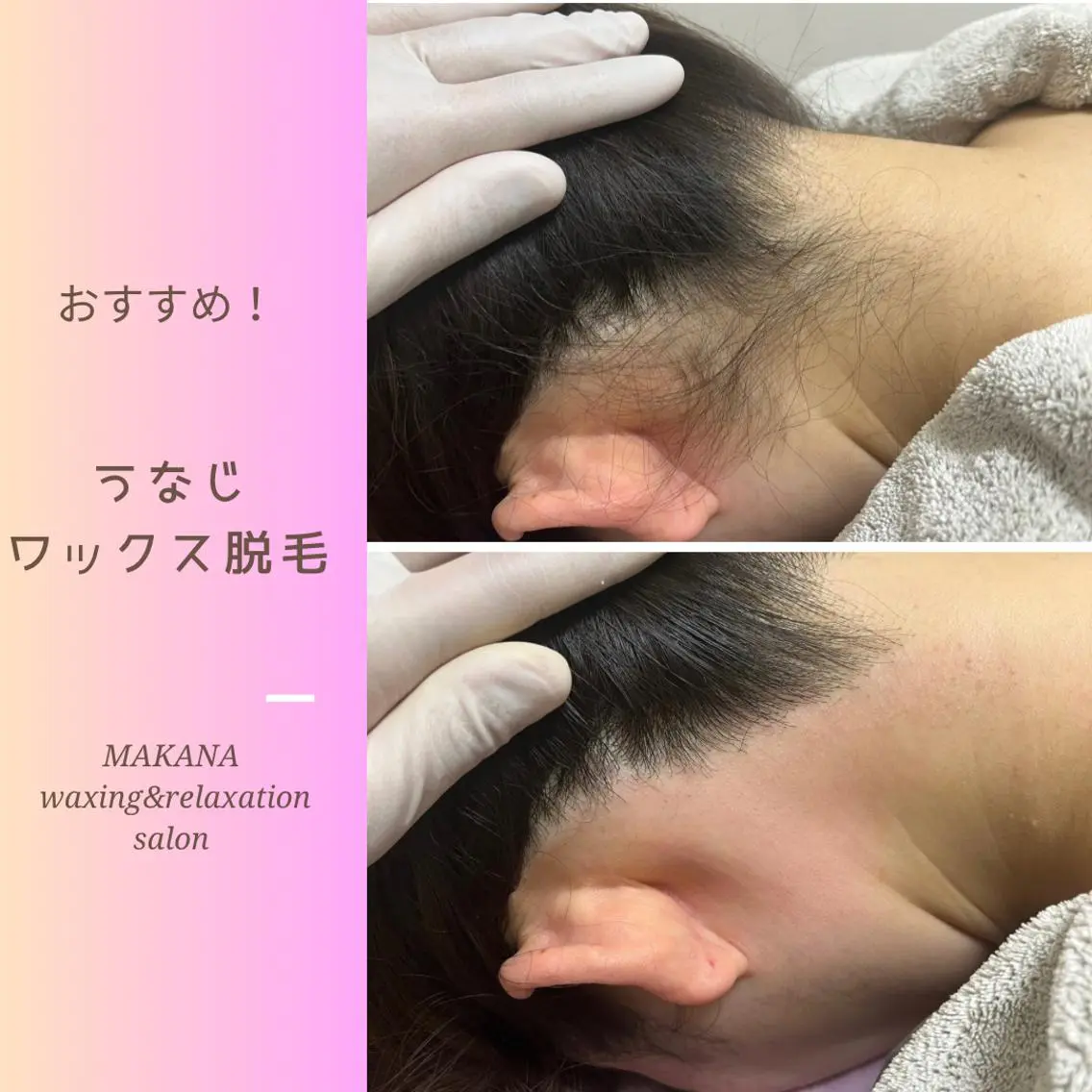 脱毛 MAKANA 吉岡 小岩店のエステ・リラクイメージ