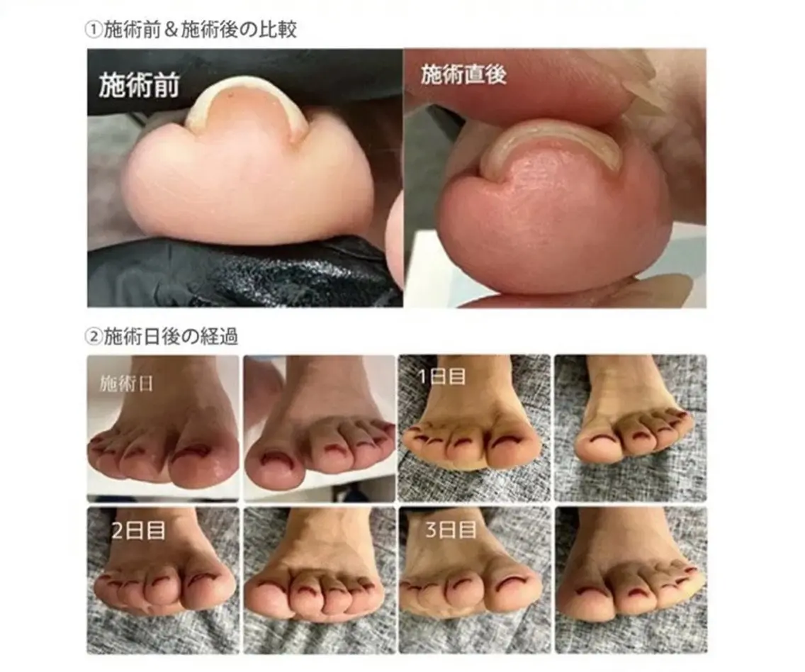 ネイル フットネイル kajitani yukinaのネイルデザイン
