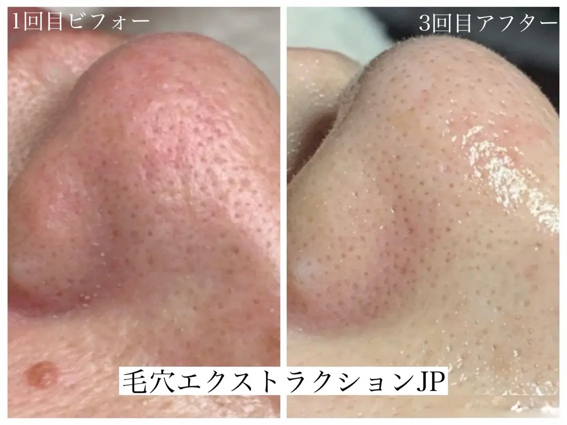 エステ 佐々木 風奈のエステ・リラクイメージ