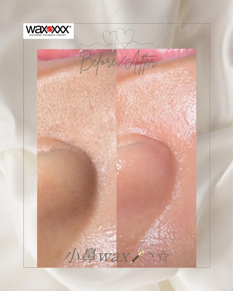 小鼻waxの写真