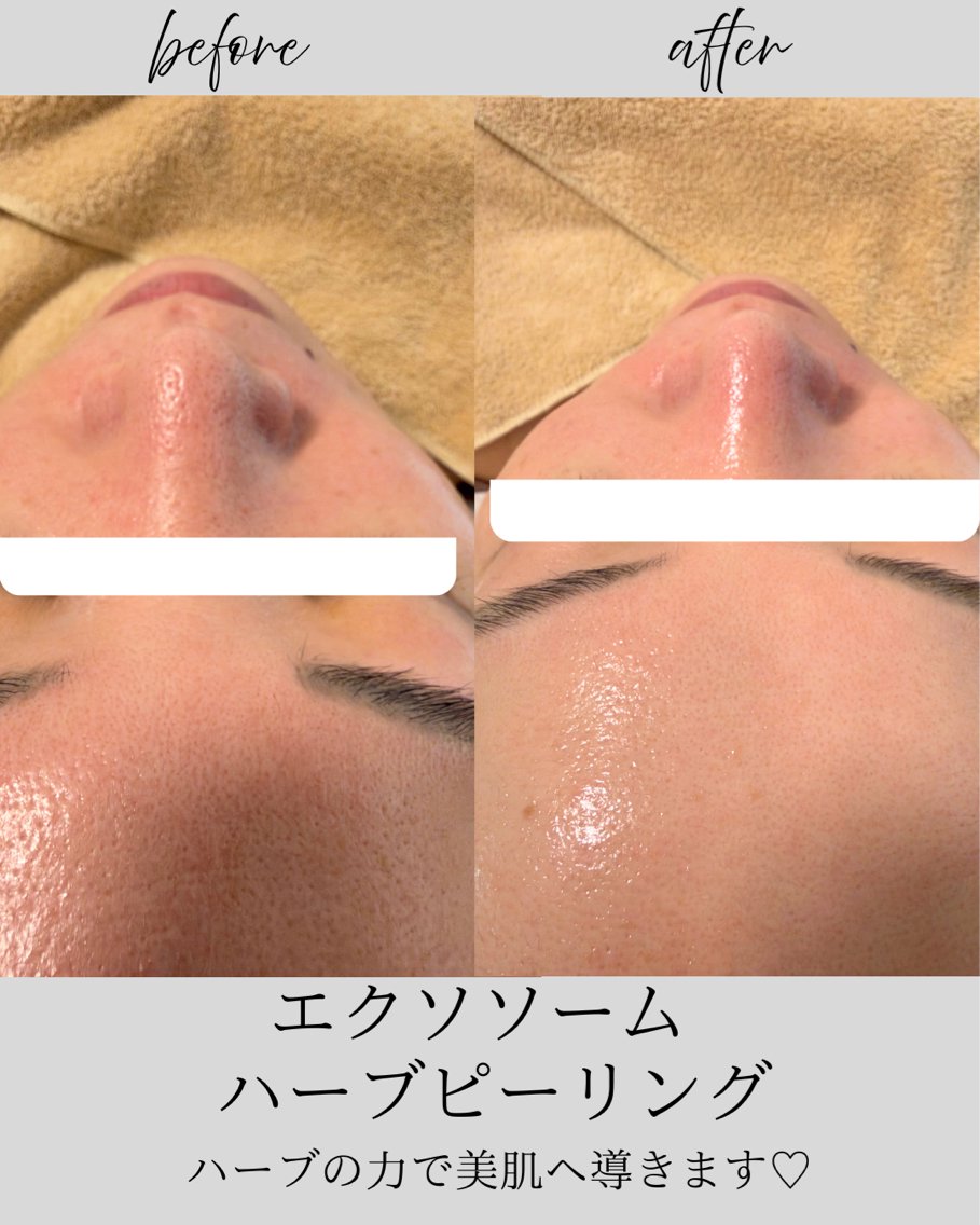 エステ SOLEILnail &beautyのエステ・リラクイメージ