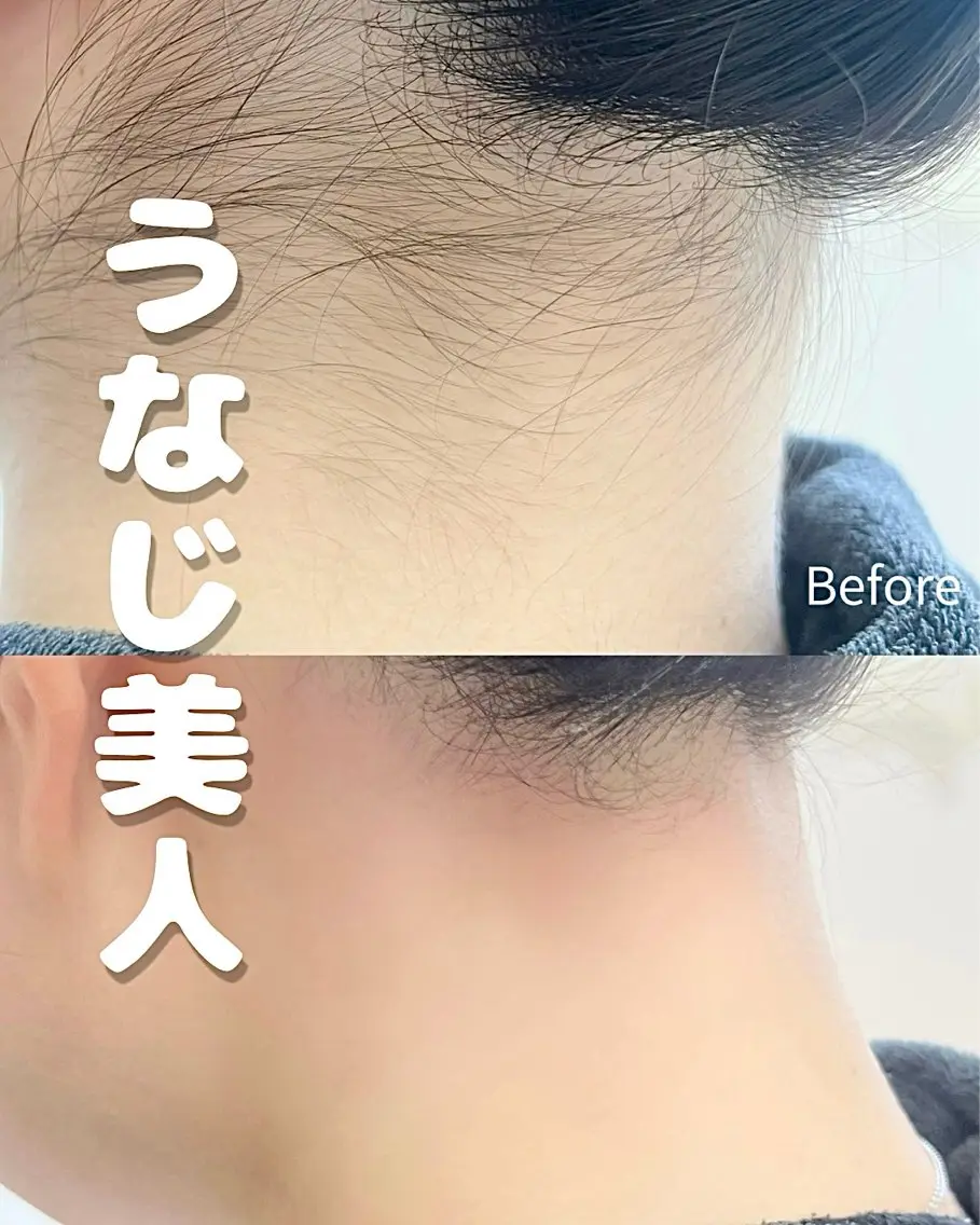 脱毛 Balance facialのエステ・リラクイメージ