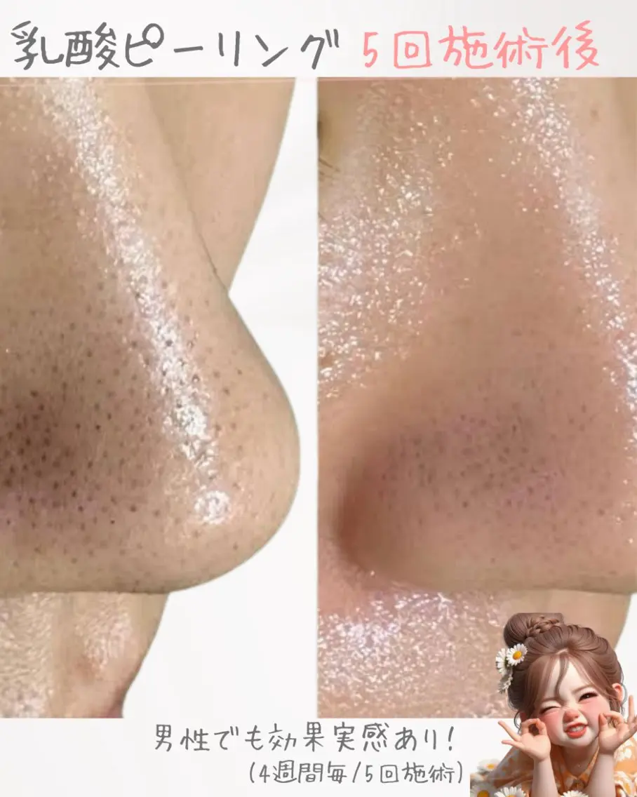 肌質改善サロン chouchouのエステ・リラクイメージ