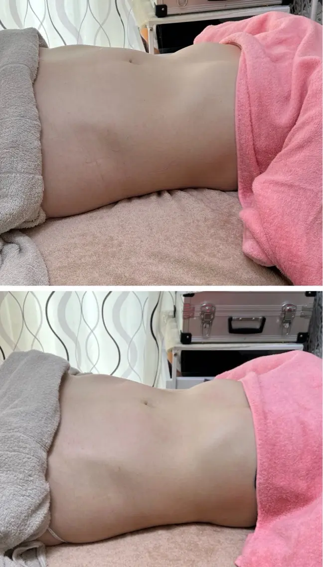 小顔と腸の専門店 ラクーラビューティーのエステ・リラクイメージ