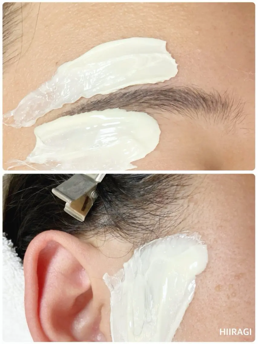 もみ上げwax脱毛＆アイブロウwax脱毛（美眉）セットコース✨トリートメントパック付き✨男性と一緒にご来店も可能ですの写真