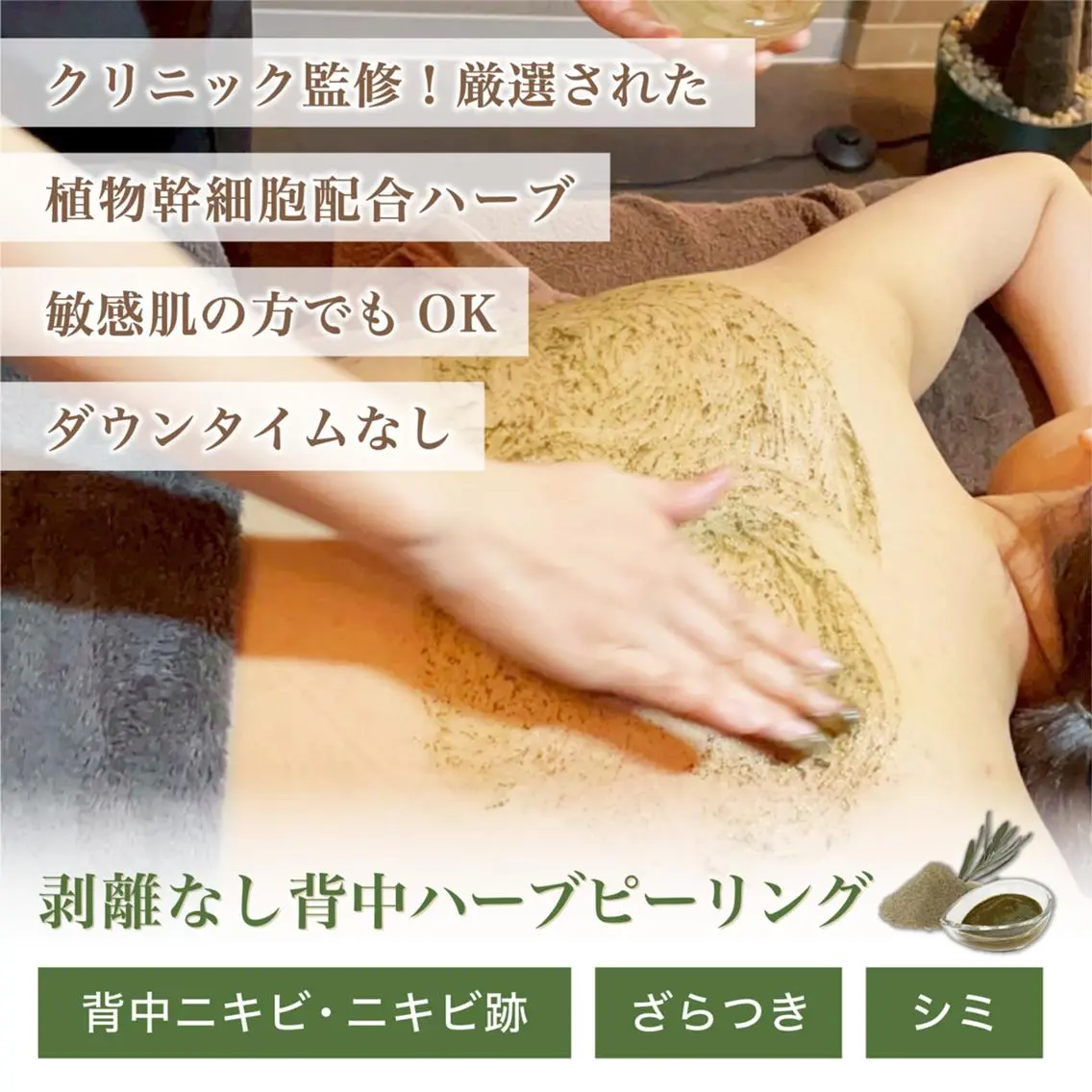 【魅せる美背中ケア◎】剥離なし背中ハーブピーリングの写真