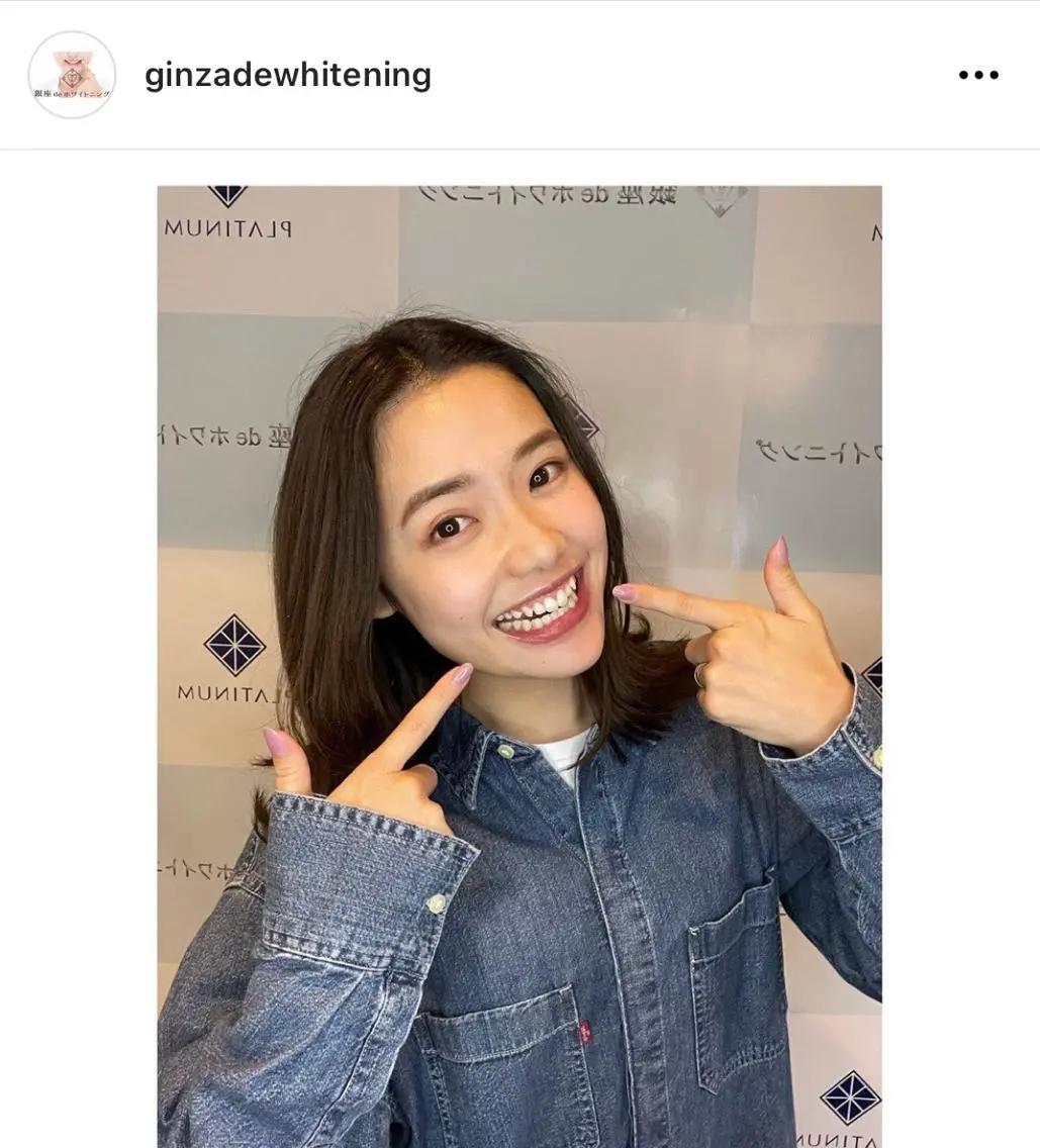 10トーン🆙⬆️も可能✨ナチュラルホワイトニング30分1回　合計30分の写真