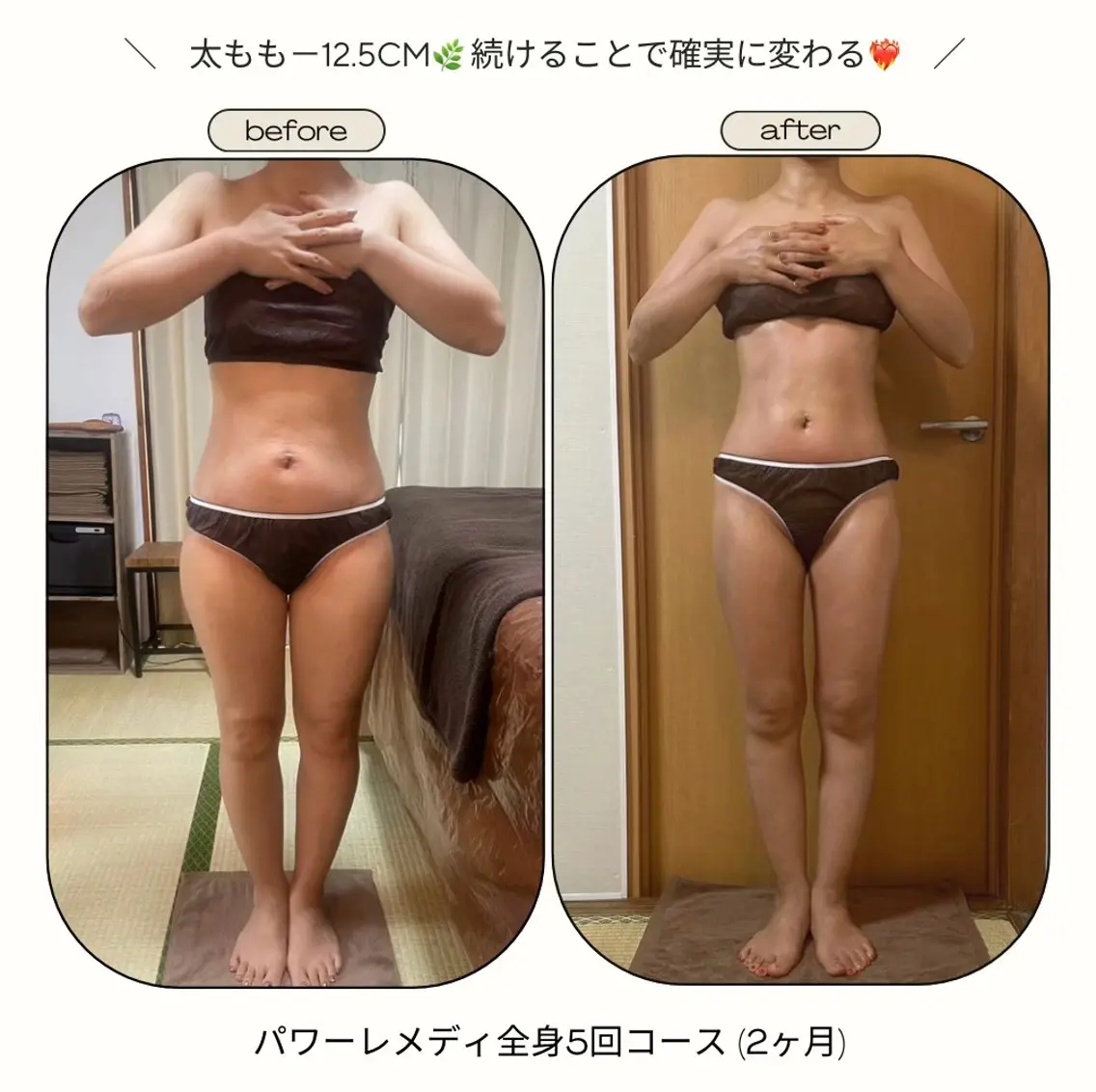 《本気痩せ×疲労改善 》  BILOOPのエステ・リラクイメージ