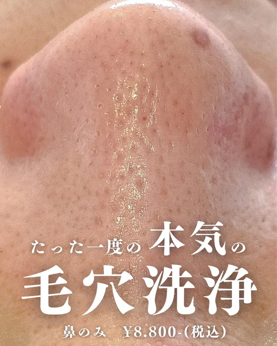エステ La･Bellvie 【星ヶ丘店]のエステ・リラクイメージ