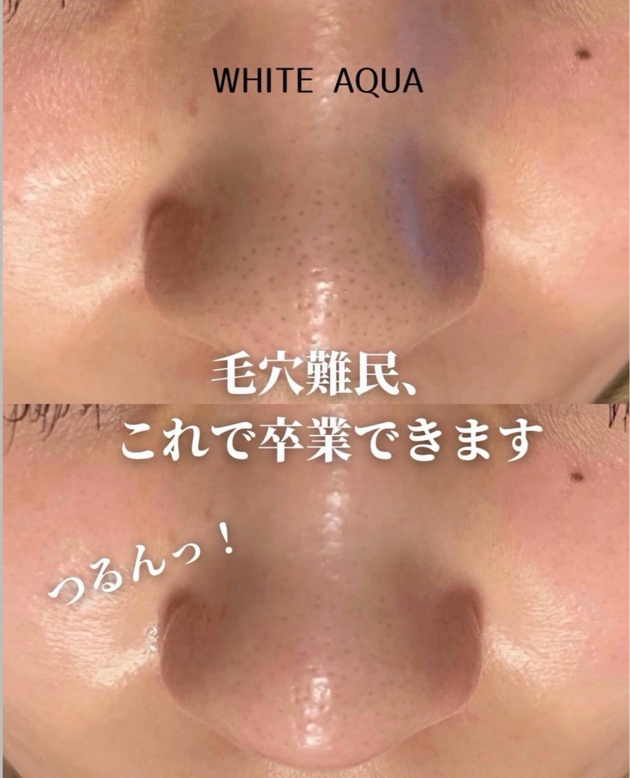 エステ 柏/肌管理専門店/ ⭐️サトウレノン🌟のエステ・リラクイメージ