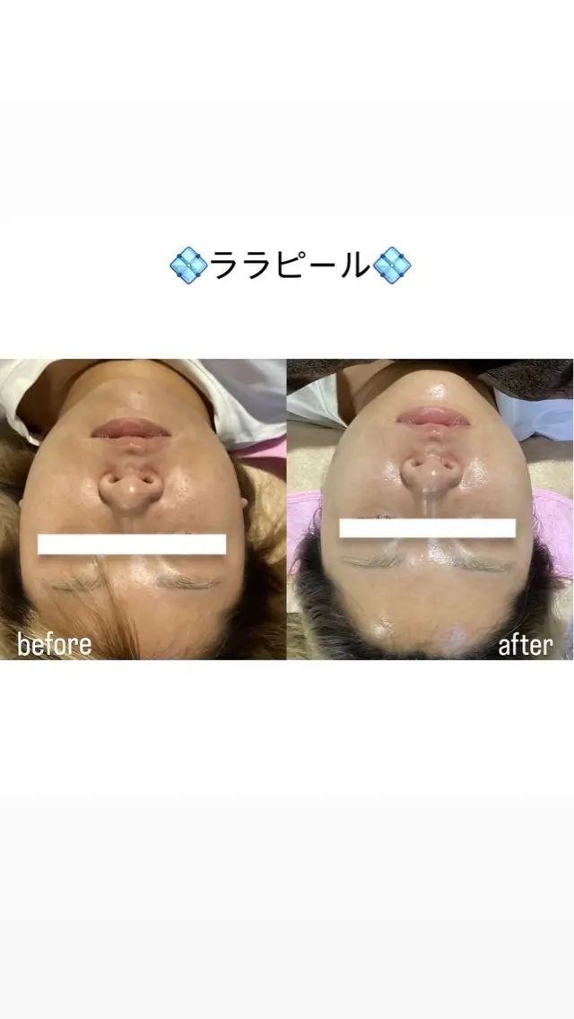 salon merci和泉のエステ・リラクイメージ
