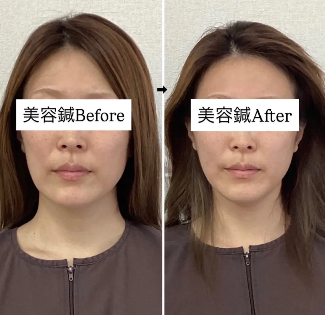 美容鍼灸×小顔整体♡ ハリサロンドオフ堺東のその他イメージ