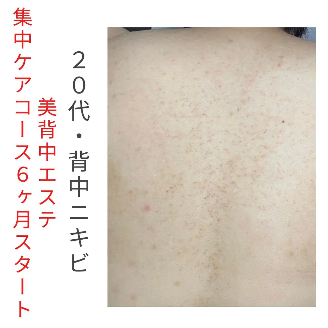 ベラージュ【美背中・ 美尻・フェイシャル】のエステ・リラクイメージ