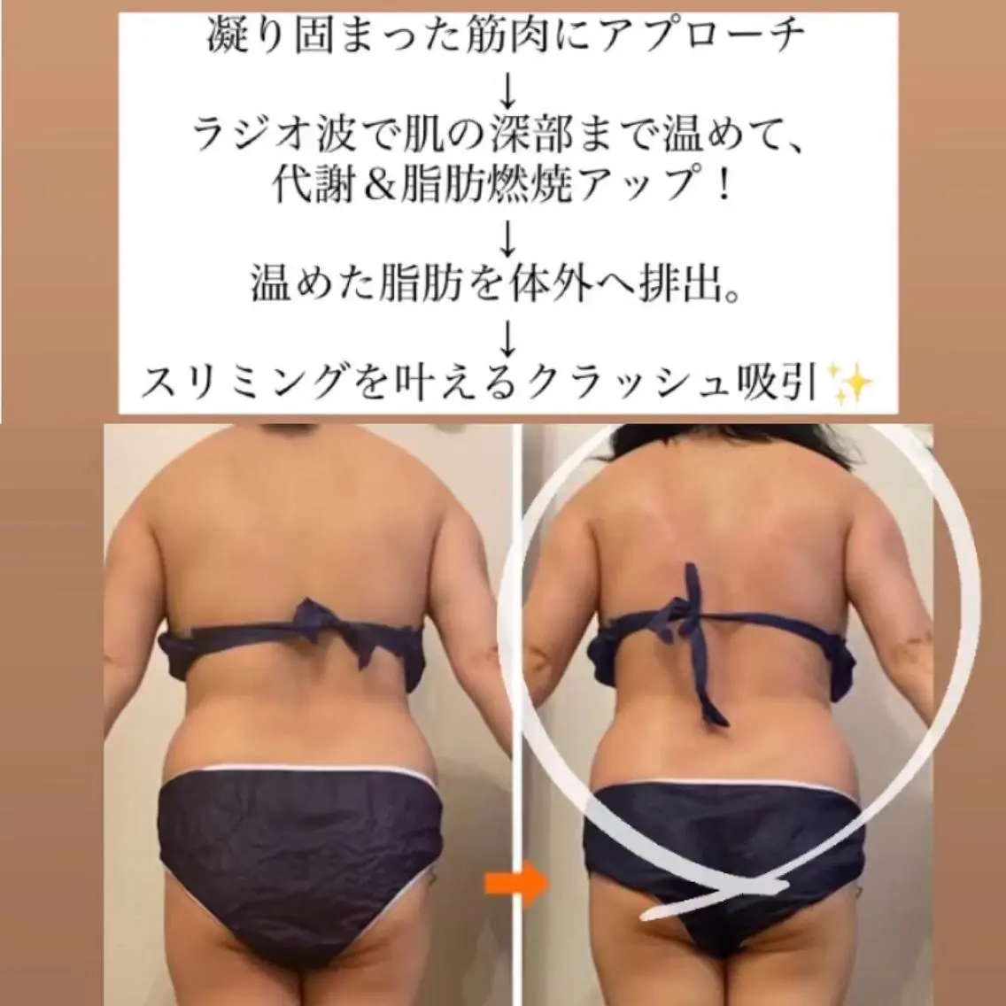 ショート カラー パーマ ヘアアレンジ メンズ キッズ ネイル マツエク・マツパ アイブロウ 痩身&ボディ 結果出し🌟丹野のエステ・リラクイメージ