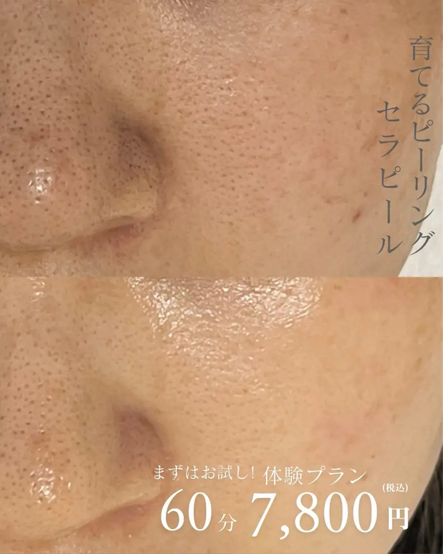 エステ 小顔&美肌 サロンLINKAのエステ・リラクイメージ