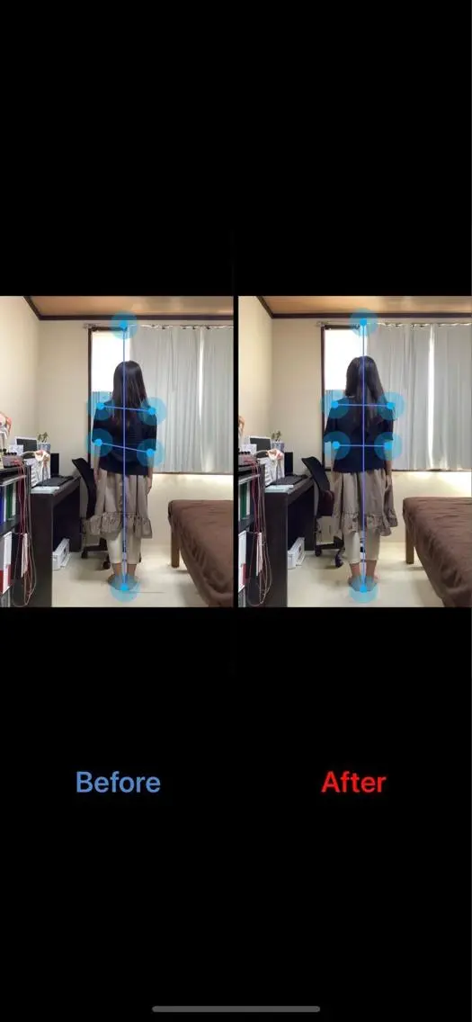 姿勢調整施術の写真