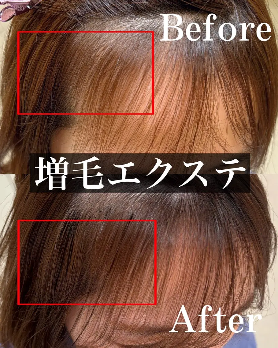 LED増毛エクステ（前髪or生え際orつむじのうち1箇所）+馴染ませカットの写真