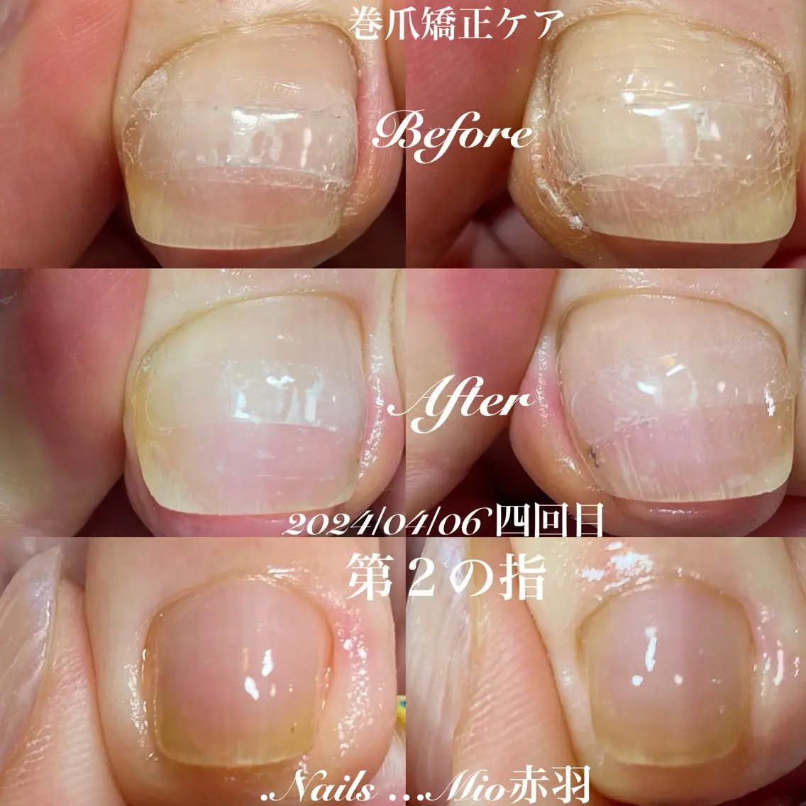 ネイル フットネイル フットネイル .Nails Mio 赤羽西ネイルサロンのネイルデザイン