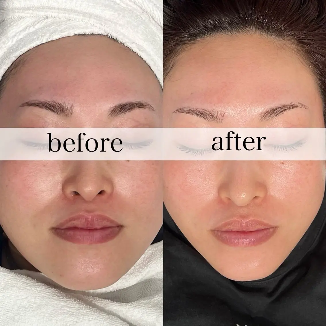 FOXYLASH inoueのエステ・リラクイメージ