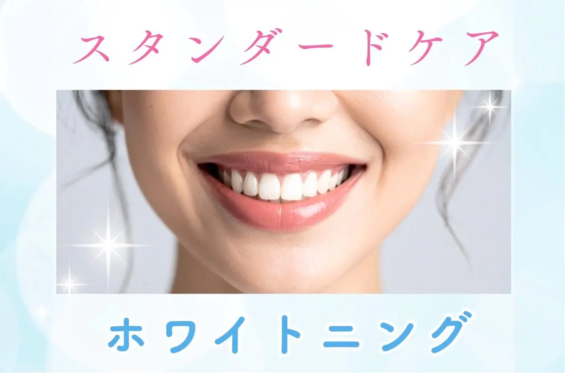 【人気No.2スタンダードケア】自然な白さからもう一歩白くしたい方に🦷✨の写真