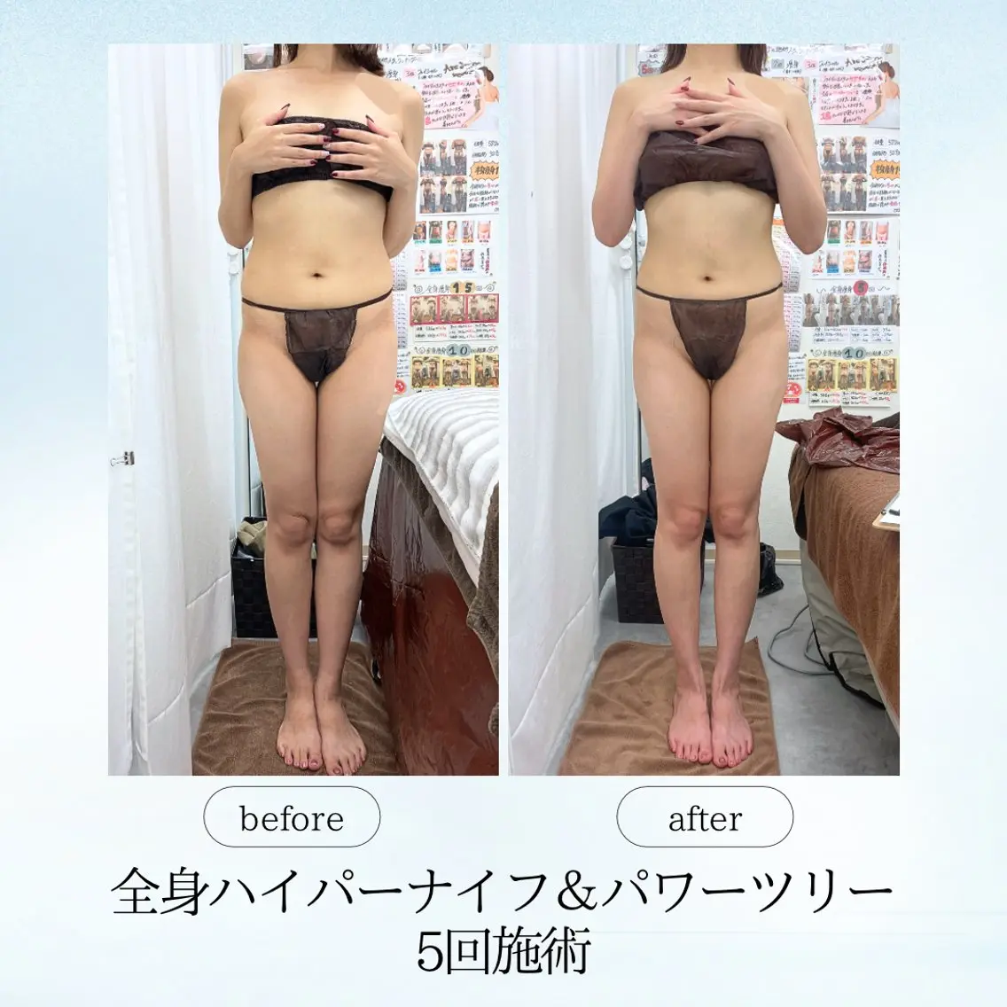エステ リラク 《痩身、小顔専門店》 エスプレッソのエステ・リラクイメージ