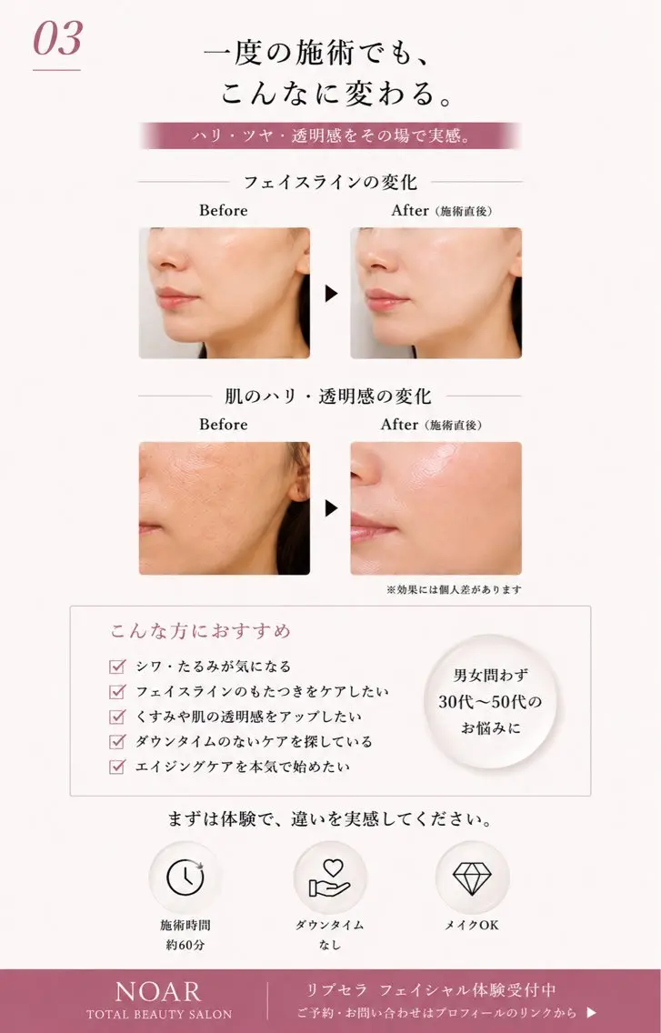 NOAR Risaのエステ・リラクイメージ