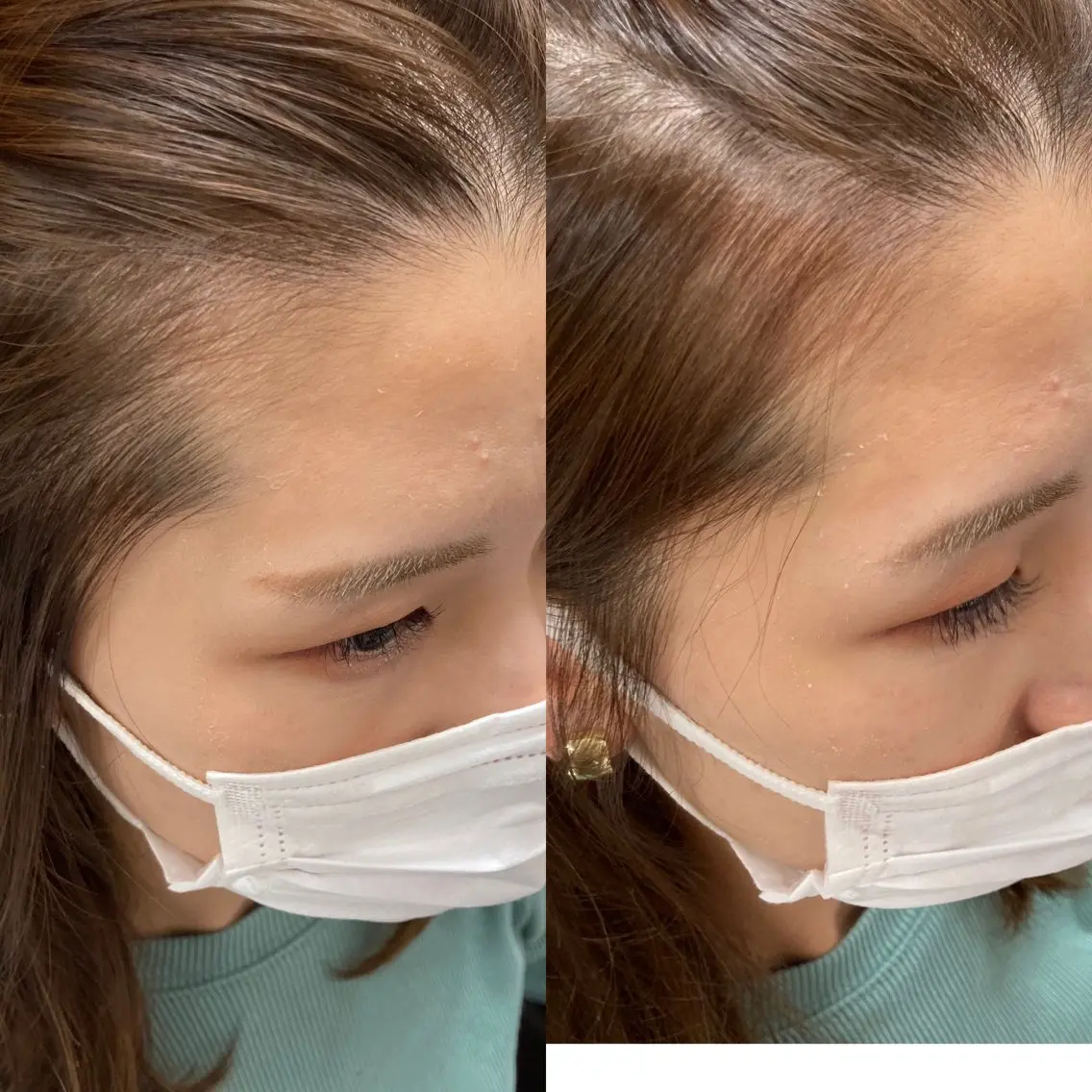 パーマ 松下 輝璃のヘアスタイル