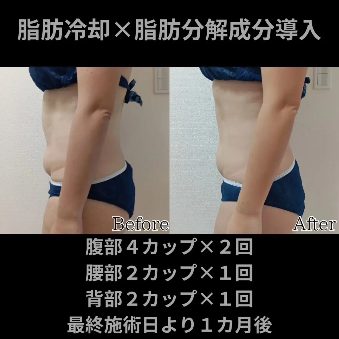 エステ Miyahara Saori.のエステ・リラクイメージ