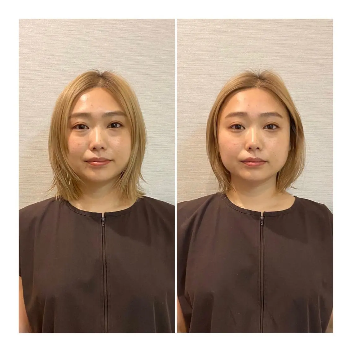 その他 即小顔♥️美容鍼× ハーブピーリングのその他イメージ
