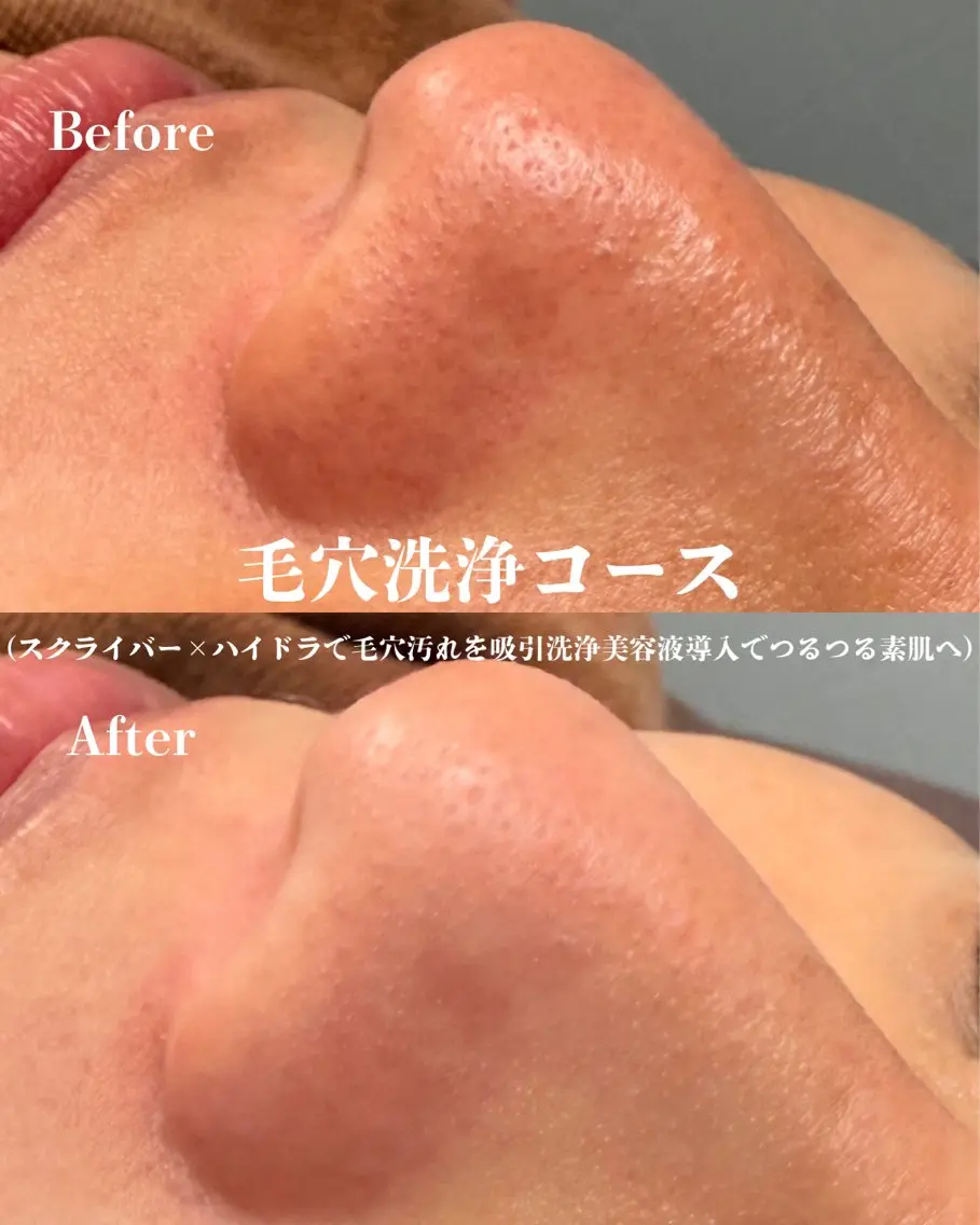 エステ D-Salon プライベートサロンのネイルデザイン